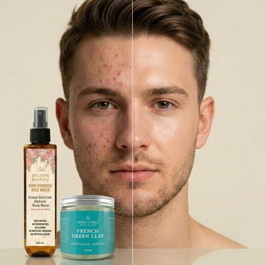 The Ultimate Men's Oil-Control Detox Combo: Pure French Green Clay (100g) + Bulgarian Rose Water (200ml)